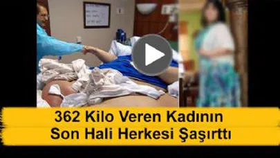 362 Kilo Veren Kadının Son Hali Bakın Ne Oldu