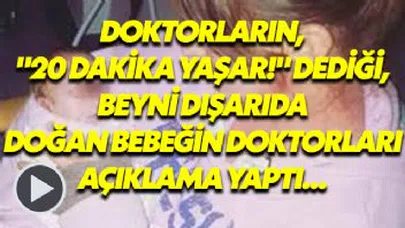 Doktorların, '20 Dakika Yaşar!' Dediği, Beyni Dışarıda Doğan Bebeğin Yaşam Mücadelesi