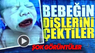 Ağzında 9 dişle doğdu!