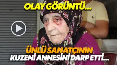 Ünlü Sanatçının Kuzeni Annesi'ni Darp Etti...