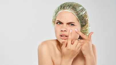 Sivilce Nedenleri ve Evde Tedavi Yöntemleri