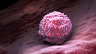 Kanser Genetik Olarak Aktarılabilir mi?