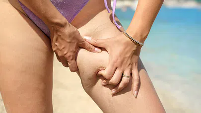 Selülit İçin Etkili Egzersizler