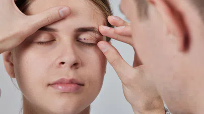 Göz Kapağı Estetiği, Daha Rahat Görme İçin Çözüm