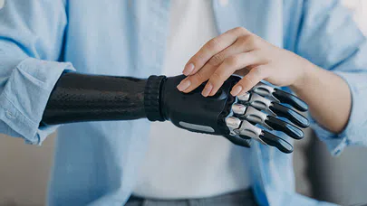 Robotik Prostetik Kollarla Hayat Yeniden Başlıyor