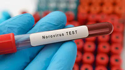 Norovirüs Alarmı! Uzmanlar Önlemleri Açıkladı