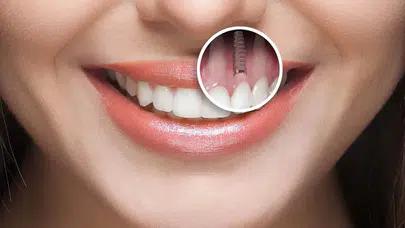 Vücudun Kendi Dişini Yapmasını Sağlayan İlaç İçin Geri Sayım Başladı