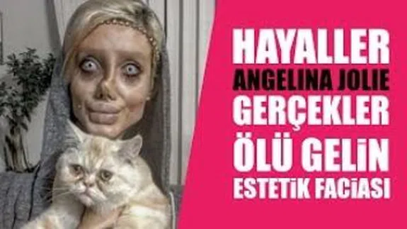 Görünce gözlerinize inanamayacaksınız... Genç kadın tanınmaz halde... 50 Ameliyat geçirdi...