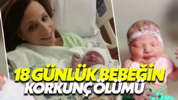 18 günlük bebek öpücük yüzünden öldü!