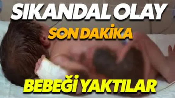 Hastanede bebeği yaktılar...