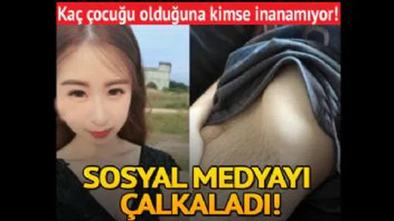 Görenler inanamıyor! Doğum izlerini görünce şok olacaksınız...