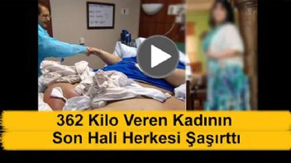362 Kilo Veren Kadının Son Hali Bakın Ne Oldu