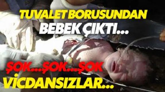 Tuvalet Borusundan Sağ Çıkartıldı...