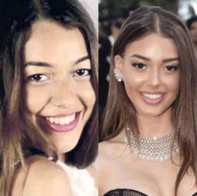 Dilan Çiçek Deniz'in estetiksiz haline yağmurlu havada su verilmez 8